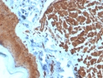 IHC staining of FFPE human skin tissue with NME2 antibody (clone NME2/4160). HIER: boil tissue sections in pH 9 10mM Tris with 1mM EDTA for 20 min and allow to cool before testing.
