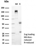 SDS-PAGE analysis of purified, BSA-free NME2 antibody (clone NME2/4160) as confirmation of integrity and purity.