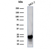Western blot testing of human MCF-7 cell lysate with NME2 antibody (clone NME2/4160). Predicted molecular weight ~17 kDa.