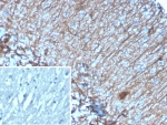 IHC staining of FFPE human brain tissue with GFAP antibody (clone GFAP/6878). Inset: PBS used in place of primary Ab (secondary Ab negative control). HIER: boil tissue sections in pH 9 10mM Tris with 1mM EDTA for 20 min and allow to cool before testing.