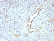 IHC staining of FFPE human uterus tissue with recombinant PECAM antibody (clone rPECAM1/8826). HIER: boil tissue sections in pH 9 10mM Tris with 1mM EDTA for 20 min and allow to cool before testing.