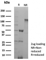 SDS-PAGE analysis of purified, BSA-free recombinant PECAM1 antibody (clone rPECAM1/8829) as confirmation of integrity and purity.