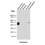 GFAP Antibody Brain Tissue WB. Western blot analysis of human brain, mouse brain, rat brain, hamster brain, and guinea pig brain tissue lysates using GFAP Antibody clone GFAP/8615R. A strong band is detected at approximately 50 kDa in human brain lysate, with an additional band of similar molecular weight observed in guinea pig brain tissue, consistent with the predicted molecular weight of Glial fibrillary acidic protein / GFAP, a major astrocytic intermediate filament protein involved in maintenance of neural cytoskeletal architecture and central nervous system integrity. Subtle lower molecular weight signal broadening beneath the primary human brain band likely reflects GFAP isoforms and/or partial proteolytic processing products commonly observed in neural tissue extracts.