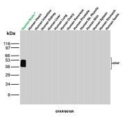 GFAP Antibody Multi-Tissue WB. Western blot analysis of human brain, heart, intestine, kidney, liver, lung, ovary, pancreas, prostate, skeletal muscle, skin, spleen, stomach, and testis tissue lysates using GFAP Antibody clone GFAP/8616R. A distinct band is detected at approximately 50 kDa selectively in human brain lysate, consistent with the predicted molecular weight of Glial fibrillary acidic protein / GFAP, an astrocyte-associated intermediate filament protein enriched within central nervous system tissue. Subtle lower molecular weight signal broadening beneath the primary band likely reflects GFAP isoforms and/or partial proteolytic processing products commonly observed in neural tissue extracts.