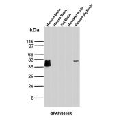 GFAP Antibody Brain Tissue WB. Western blot analysis of human brain, mouse brain, rat brain, hamster brain, and guinea pig brain tissue lysates using GFAP Antibody clone GFAP/8616R. A strong band is detected at approximately 50 kDa in human brain lysate, with an additional band of similar molecular weight observed in guinea pig brain tissue, consistent with the predicted molecular weight of Glial fibrillary acidic protein / GFAP, a major astrocytic intermediate filament protein involved in maintenance of neural cytoskeletal organization and central nervous system integrity. Multiple faint lower molecular weight bands forming a subtle stacked pattern beneath the primary human brain signal likely represent GFAP isoforms and/or partial proteolytic processing products commonly observed in neural tissue extracts.