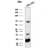 Western blot testing of human HEK293 cell lysate with NME2 antibody (clone NME2/6433). Predicted molecular weight ~17 kDa.