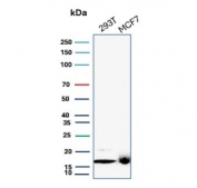 Western blot testing of human 293T and MCF-7 cell lysate with NME2 antibody (clone NME2/6433). Predicted molecular weight ~17 kDa.