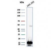 Western blot testing of human HEK293 cell lysate with Nucleoside diphosphate kinase B antibody (clone NME2/6434). Predicted molecular weight ~17 kDa.
