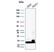 Western blot testing of human 293T and MCF7 cell lysate with Nucleoside diphosphate kinase B antibody (clone NME2/6434). Predicted molecular weight ~17 kDa.