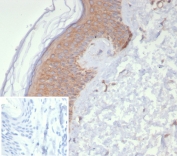 IHC staining of FFPE human kidney tissue with NDKB antibody (clone NME2/6437). Inset: PBS used in place of primary Ab (secondary Ab negative control). HIER: boil tissue sections in pH 9 10mM Tris with 1mM EDTA for 20 min and allow to cool before testing.