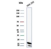 Western blot testing of human MCF-7 cell lysate with NDKB antibody (clone NME2/6437). Predicted molecular weight ~17 kDa.
