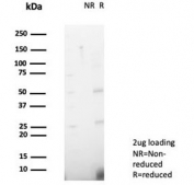 SDS-PAGE analysis of purified, BSA-free NDKB antibody (clone NME2/6437) as confirmation of integrity and purity.