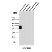 Recombinant GFAP Antibody Brain Tissue WB. Western blot analysis of human brain, mouse brain, rat brain, guinea pig brain, and hamster brain tissue lysates using recombinant GFAP Antibody clone rGFAP/8685. A strong band is detected at approximately 50 kDa in human brain lysate, consistent with the predicted molecular weight of Glial fibrillary acidic protein / GFAP, a major astrocytic intermediate filament protein involved in maintenance of neural cytoskeletal organization and central nervous system structural integrity. Subtle lower molecular weight bands forming a faint stacked pattern beneath the primary signal likely represent GFAP isoforms and/or partial proteolytic processing products commonly observed in brain-derived tissue lysates.