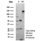 SDS-PAGE analysis of purified, BSA-free recombinant GFAP antibody (clone rGFAP/8685) as confirmation of integrity and purity.