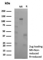 SDS-PAGE analysis of purified, BSA-free recombinant NGFR antibody (clone rNGFR/8824) as confirmation of integrity and purity.