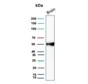 Western blot testing of human brain tissue lysate with GFAP antibody (clone GFAP/6886).