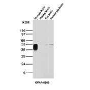 GFAP Antibody Brain Tissue WB. Western blot analysis of human brain, mouse brain, rat brain, guinea pig brain, and hamster brain tissue lysates using GFAP Antibody clone GFAP/6886. A strong band is detected at approximately 50 kDa in human brain lysate, with additional bands of similar molecular weight observed in rat and guinea pig brain samples, consistent with the predicted molecular weight of Glial fibrillary acidic protein / GFAP, an astrocytic intermediate filament protein involved in maintenance of neural cytoskeletal structure and central nervous system integrity. Subtle lower molecular weight signal broadening beneath the primary human brain band likely reflects GFAP isoforms and/or partial proteolytic processing products commonly observed in brain tissue extracts.