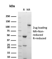 SDS-PAGE Analysis of Purified recombinant Myeloperoxidase antibody (clone MPO/8997R). Confirmation of Purity and Integrity of Antibody.