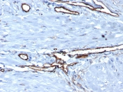 IHC staining of FFPE human placental tissue with CD31 antibody (clone PECAM1/3539). HIER: boil tissue sections in pH 9 10mM Tris with 1mM EDTA for 20 min and allow to cool before testing.