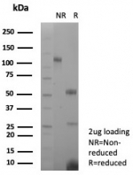 SDS-PAGE analysis of purified, BSA-free recombinant PECAM-1 antibody (clone rPECAM1/8827) as confirmation of integrity and purity.