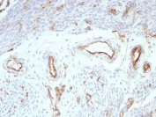 IHC staining of FFPE human uterus tissue with recombinant PECAM-1 antibody (clone rPECAM1/8827). HIER: boil tissue sections in pH 9 10mM Tris with 1mM EDTA for 20 min and allow to cool before testing.