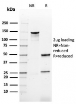 SDS-PAGE analysis of purified, BSA-free CD79b antibody (clone CD79b/4960) as confirmation of integrity and purity.