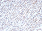 IHC staining of FFPE human heart tissue with Cadherin 2 antibody (clone CDH2/8862R). HIER: boil tissue sections in pH 9 10mM Tris with 1mM EDTA for 20 min and allow to cool before testing.