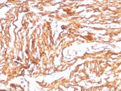 IHC staining of FFPE human heart tissue with N-Cadherin antibody (clone CDH2/8998R). HIER: boil tissue sections in pH 9 10mM Tris with 1mM EDTA for 20 min and allow to cool before testing.