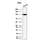Western blot testing of human heart tissue lysate with N-Cadherin antibody (clone CDH2/8998R). Predicted molecular weight ~100 kDa (unmodified), 125-140 kDa (modified).
