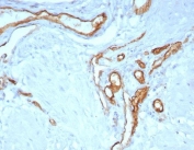 IHC staining of FFPE human uterus tissue with CD31 antibody (clone C31/8243R). HIER: boil tissue sections in pH 9 10mM Tris with 1mM EDTA for 20 min and allow to cool before testing.