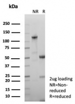 SDS-PAGE analysis of purified, BSA-free Growth Hormone antibody (clone GH/8215R) as confirmation of integrity and purity.