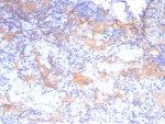 IHC staining of FFPE human pituitary tissue with Growth Hormone antibody (clone GH/8215R). HIER: boil tissue sections in pH 9 10mM Tris with 1mM EDTA for 20 min and allow to cool before testing.