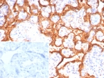 IHC staining of FFPE human placental tissue with Growth Hormone antibody (clone GH/8215R). Inset: PBS used in place of primary Ab (secondary Ab negative control). HIER: boil tissue sections in pH 9 10mM Tris with 1mM EDTA for 20 min and allow to cool before testing.