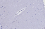 Negative control: IHC testing of FFPE human brain tissue with TIMP2 antibody (clone TIMP2/8193R) at 2ug/ml. HIER: boil tissue sections in pH 9 10mM Tris with 1mM EDTA for 20 min and allow to cool before testing.