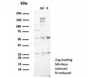 SDS-PAGE analysis of purified, BSA-free SSTR2 antibody (clone SSTR2/7532) as confirmation of integrity and purity.
