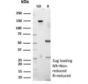 SDS-PAGE analysis of purified, BSA-free SSTR2 antibody (clone SSTR2/7532) as confirmation of integrity and purity.