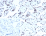 IHC staining of FFPE human placental tissue with RBFOX3 antibody (clone NEUN/7167). Inset: PBS used in place of primary Ab (secondary Ab negative control). HIER: boil tissue sections in pH 9 10mM Tris with 1mM EDTA for 20 min and allow to cool before testing.
