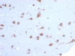 IHC staining of FFPE human brain tissue with RBFOX3 antibody (clone NEUN/7167). HIER: boil tissue sections in pH 9 10mM Tris with 1mM EDTA for 20 min and allow to cool before testing.