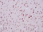 IHC staining of FFPE human cerebrum with RBFOX3 antibody (clone NEUN/7168). HIER: boil tissue sections in pH 9 10mM Tris with 1mM EDTA for 20 min and allow to cool before testing.