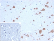 IHC staining of FFPE human brain tissue with RBFOX3 antibody (clone NEUN/7168). Inset: PBS used in place of primary Ab (secondary Ab negative control). HIER: boil tissue sections in pH 9 10mM Tris with 1mM EDTA for 20 min and allow to cool before testing.