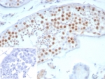 IHC staining of FFPE human testis tissue with Survivin antibody (clone BIRC5/7775). Inset: PBS used in place of primary Ab (secondary Ab negative control). HIER: boil tissue sections in pH 9 10mM Tris with 1mM EDTA for 20 min and allow to cool before testing.