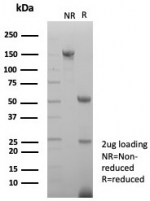 SDS-PAGE analysis of purified, BSA-free Survivin antibody (clone BIRC5/7778) as confirmation of integrity and purity.