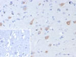 IHC staining of FFPE human brain tissue with recombinant NeuN antibody (clone rNEUN/8055). Inset: PBS used in place of primary Ab (secondary Ab negative control). HIER: boil tissue sections in pH 9 10mM Tris with 1mM EDTA for 20 min and allow to cool before testing.
