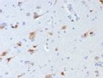 IHC staining of FFPE human brain tissue with NeuN antibody (clone rNEUN/8054). HIER: boil tissue sections in pH 9 10mM Tris with 1mM EDTA for 20 min and allow to cool before testing.