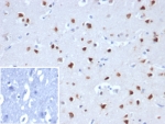 IHC staining of FFPE human cerebellum tissue with RBFOX3 antibody (clone NEUN/8096R). Inset: PBS used in place of primary Ab (secondary Ab negative control). HIER: boil tissue sections in pH 9 10mM Tris with 1mM EDTA for 20 min and allow to cool before testing.