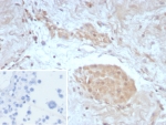 IHC staining of FFPE human testis tissue with Survivin antibody (clone BIRC5/8987R). Inset: PBS used in place of primary Ab (secondary Ab negative control). HIER: boil tissue sections in pH 9 10mM Tris with 1mM EDTA for 20 min and allow to cool before testing.