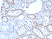 CDH2 Antibody Kidney Tissue IHC. Immunohistochemical analysis of N-Cadherin / CDH2 expression in formalin-fixed, paraffin-embedded human kidney tissue using recombinant CDH2 antibody clone rCDH2/8291. Distinct membranous and cytoplasmic staining is observed in renal tubular epithelial cells, highlighting cell-cell junctions consistent with the known localization of N-Cadherin in epithelial adhesion structures. Glomerular regions show minimal to low staining. The inset represents a negative control with primary antibody omitted, demonstrating low background signal. HIER: boil tissue sections in pH 9 10mM Tris with 1mM EDTA for 20 min and allow to cool before testing.