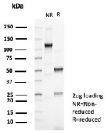 SDS-PAGE analysis of purified, BSA-free recombinant CDH2 antibody (clone rCDH2/8291) as confirmation of integrity and purity.