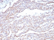 IHC staining of FFPE human heart tissue with NCAD antibody (clone CDH2/8815R). HIER: boil tissue sections in pH 9 10mM Tris with 1mM EDTA for 20 min and allow to cool before testing.
