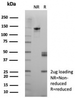 SDS-PAGE analysis of purified, BSA-free DSG3 antibody (clone rDSG3/8611) as confirmation of integrity and purity.